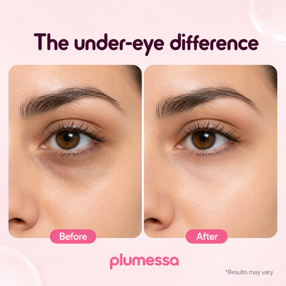 Plumessa™ Calcium Dark Spot Eye Cream