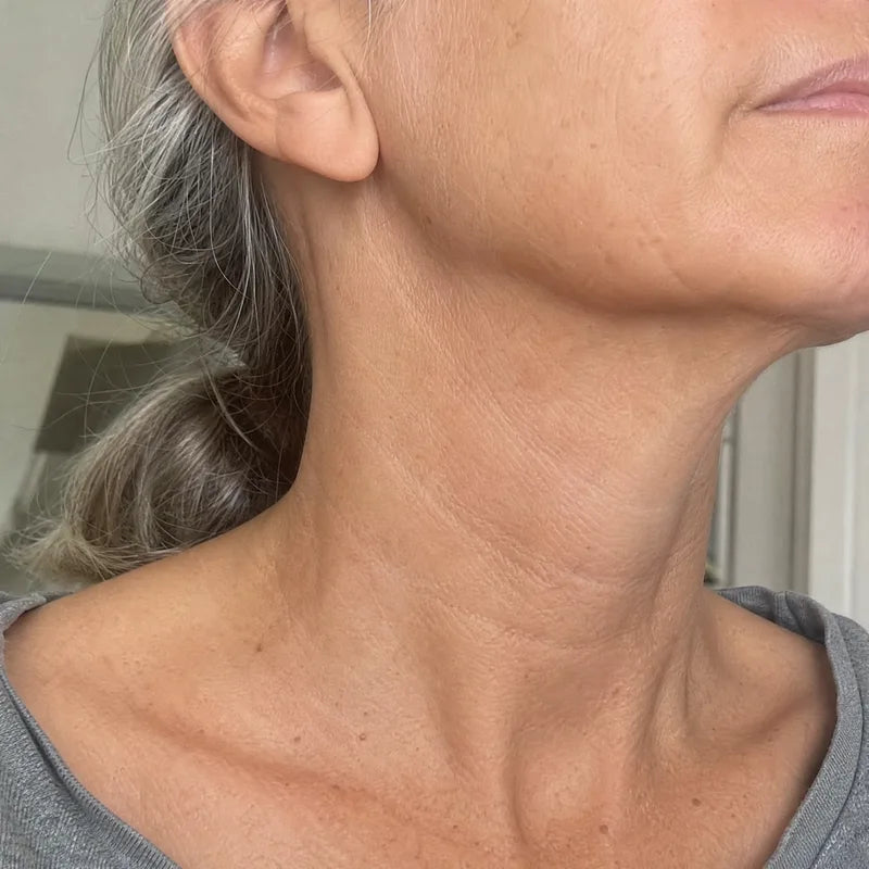 Neck before Plumessa