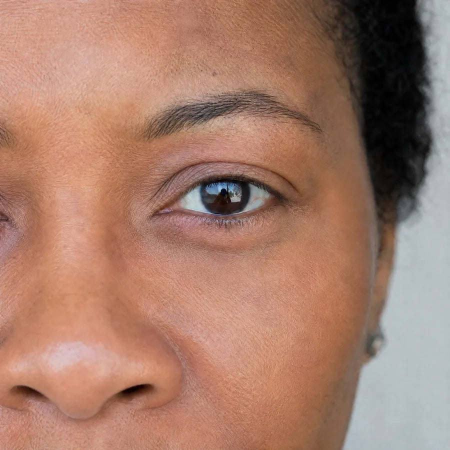 Fine lines after Plumessa